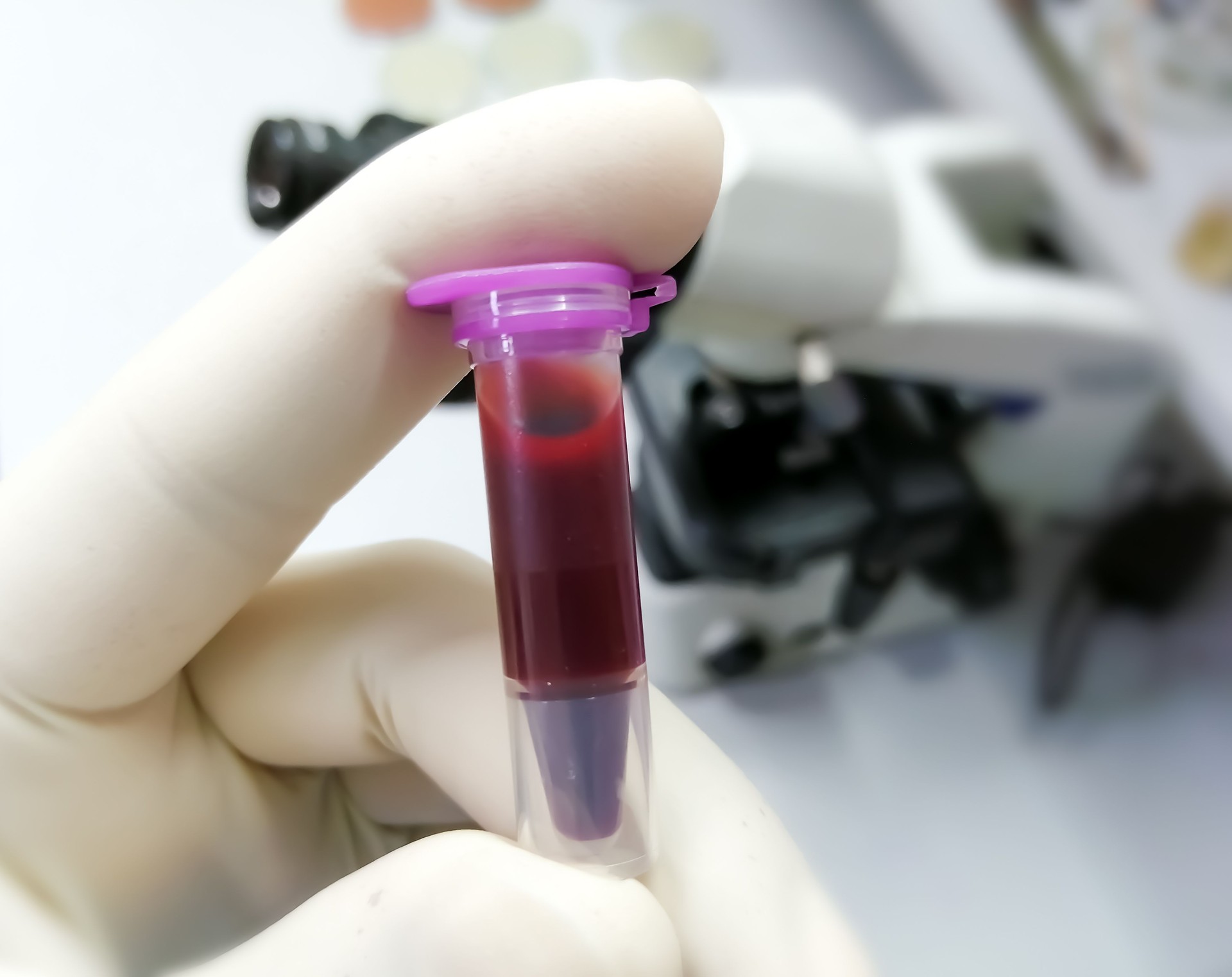 Scientist hold a Eppendorf with blood sample which is ready for further examination. laboratory background.